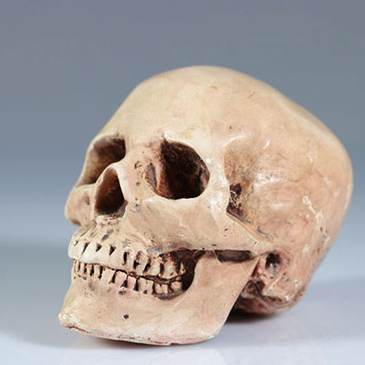 France - Skull in plaster - 1900