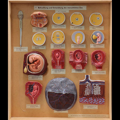Modèle anatomique organes internes de femme en cire